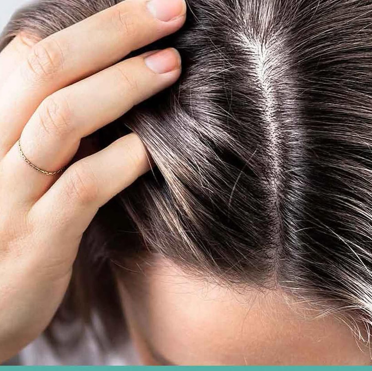 اسکراب کف سر طلای ار بی RB