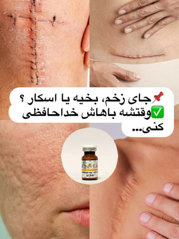 کوکتل اسکار مزولایک اسپانیا حجم ده میل