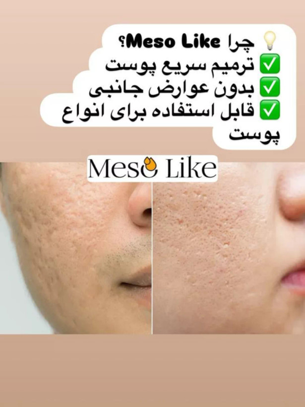 کوکتل اسکار مزولایک اسپانیا حجم ده میل