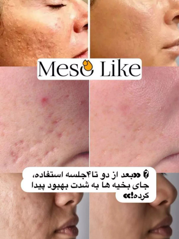 کوکتل اسکار مزولایک اسپانیا حجم ده میل
